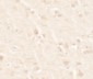 B2M Antibody